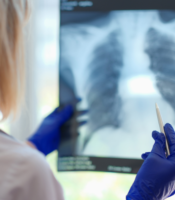 Pneumologista